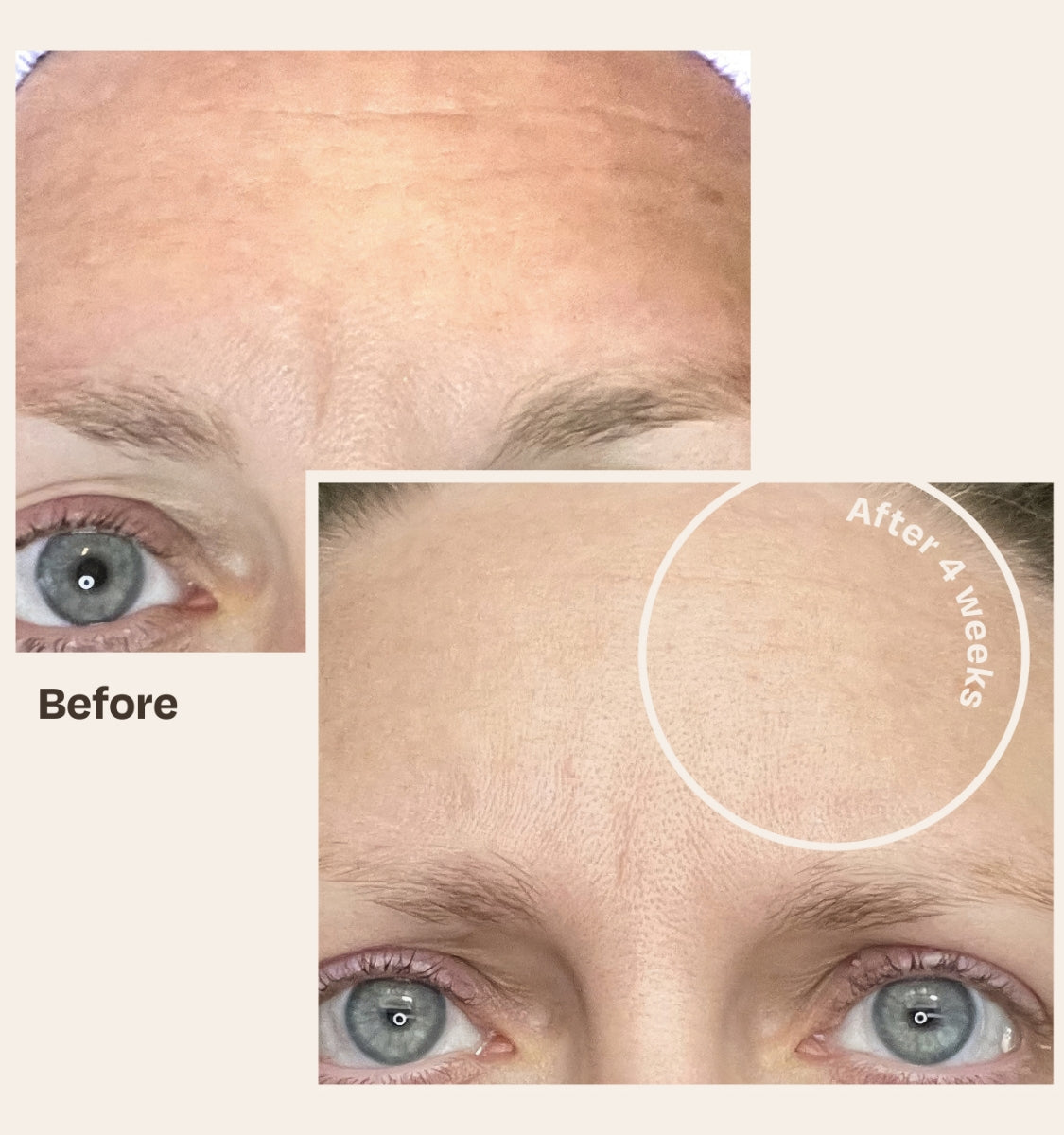 Before and After use of Vita Trio - Auria